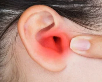 20190303160444-400x350