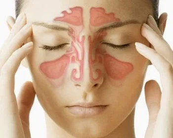 sinusite-400x350